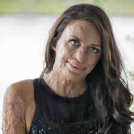 Turia Pitt