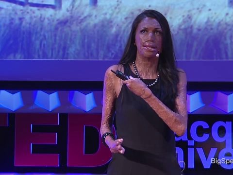 Unmask your potential – Turia Pitt